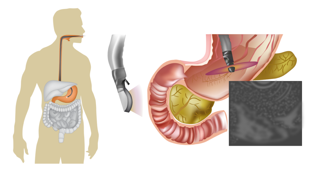 endoscopy-call-to-schedule-your-procedure-today